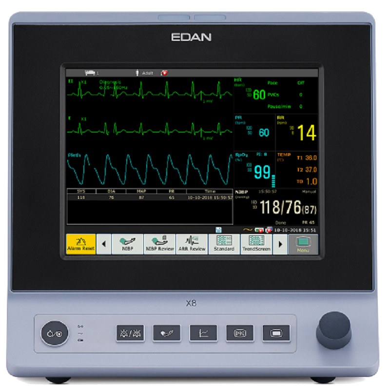 Монітор пацієнта EDAN X8